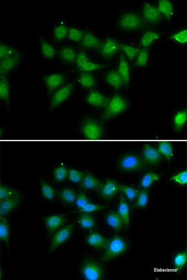 Western blot analysis of extracts of various cell lines using DACH1 Polyclonal Antibody at dilution of 1:1000.