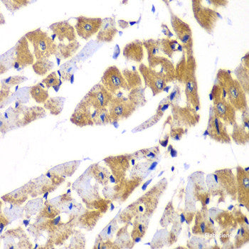 Immunohistochemistry of paraffin-embedded Mouse brain using DGUOK Polyclonal Antibody at dilution of 1:100 (40x lens).