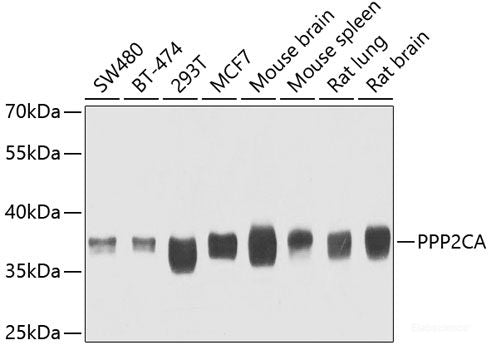 Immunofluorescence analysis of A549 cells using ELF1 Polyclonal Antibody