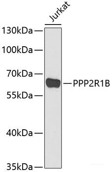 Immunohistochemistry of paraffin-embedded Rat kidney using ENPEP Polyclonal Antibody at dilution of 1:200 (40x lens).