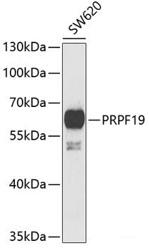 Western blot analysis of extracts of Mouse liver using FMO1 Polyclonal Antibody at dilution of 1:1000.