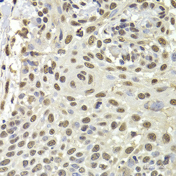 Immunohistochemistry of paraffin-embedded Rat brain using GALNT2 Polyclonal Antibody at dilution of 1:100 (40x lens).