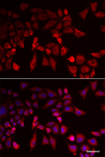 Western blot analysis of extracts of 5637(HTB-9) cells using GBP1 Polyclonal Antibody at dilution of 1:1000.
