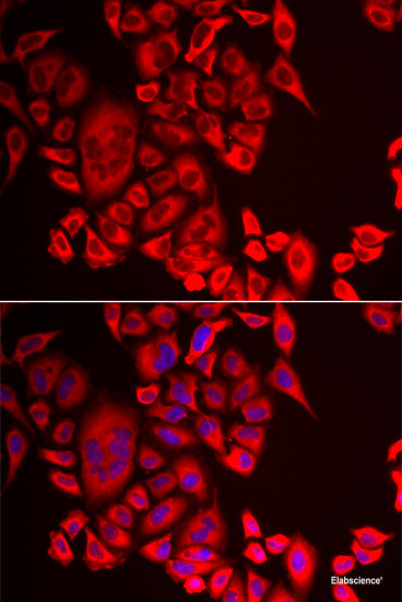 Western blot analysis of extracts of Mouse eye using BLOC1S1 Polyclonal Antibody at dilution of 1:1000.