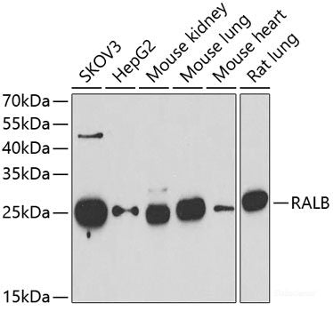 Immunofluorescence analysis of A549 cells using GIF Polyclonal Antibody