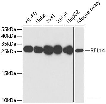 Immunofluorescence analysis of U2OS cells using HOXB7 Polyclonal Antibody