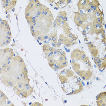 Immunohistochemistry of paraffin-embedded Rat intestine using HPGD Polyclonal Antibody at dilution of 1:100 (40x lens).