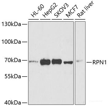 Western blot analysis of extracts of various cell lines using KCND3 Polyclonal Antibody at dilution of 1:1000.