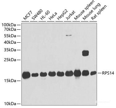 Immunofluorescence analysis of MCF7 cells using LGALS3BP Polyclonal Antibody