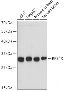 Immunohistochemistry of paraffin-embedded Rat brain using MYH1 Polyclonal Antibody at dilution of 1:100 (40x lens).
