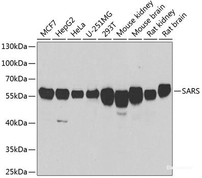 Immunohistochemistry of paraffin-embedded Rat brain using HNRNPM Polyclonal Antibody at dilution of 1:100 (40x lens).