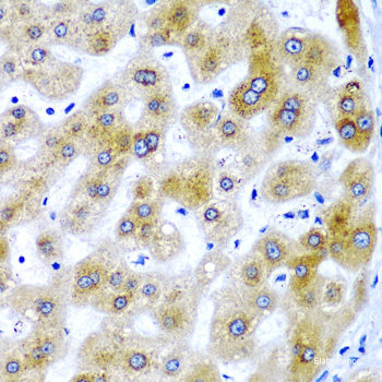Immunohistochemistry of paraffin-embedded Rat retina using PDE6B Polyclonal Antibody at dilution of 1:200 (40x lens).