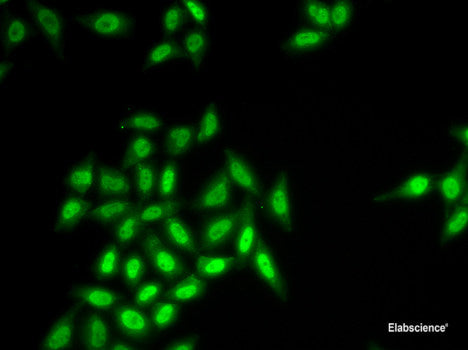 Immunohistochemistry of paraffin-embedded Rat ovary using PFKFB3 Polyclonal Antibody at dilution of 1:100 (40x lens).