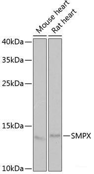Immunofluorescence analysis of MCF7 cells using PPL Polyclonal Antibody