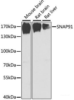 Immunohistochemistry of paraffin-embedded Rat kidney using PRKAB2 Polyclonal Antibody at dilution of 1:100 (40x lens).