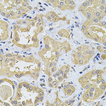 Immunohistochemistry of paraffin-embedded Rat kidney using PSMD5 Polyclonal Antibody at dilution of 1:100 (40x lens).