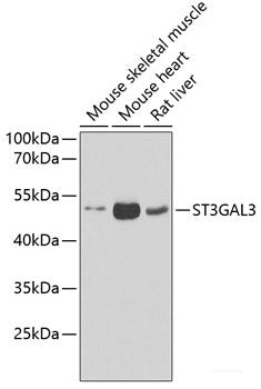 Immunohistochemistry of paraffin-embedded Human prostate using RAD51C Polyclonal Antibody at dilution of 1:100 (40x lens).
