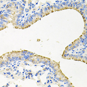 Immunohistochemistry of paraffin-embedded Rat Intestine using RBBP5 Polyclonal Antibody at dilution of 1:100 (40x lens).