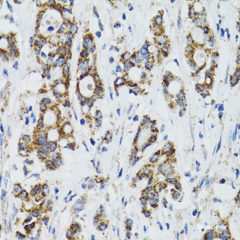 Immunofluorescence analysis of A-549 cells using RBBP6 Polyclonal Antibody