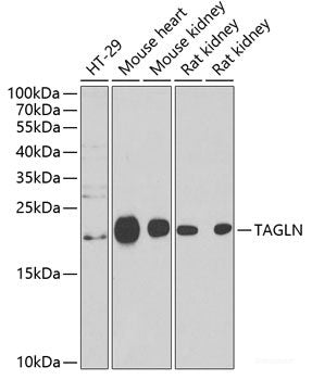 Western blot analysis of extracts of 22Rv1 cells using RLN2 Polyclonal Antibody at dilution of 1:1000.