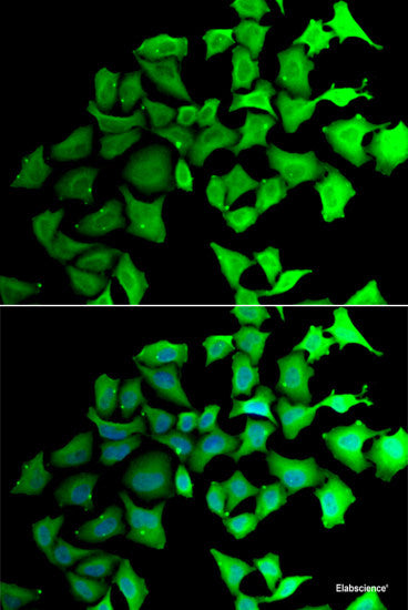 Immunofluorescence analysis of U2OS cells using RPLP2 Polyclonal Antibody