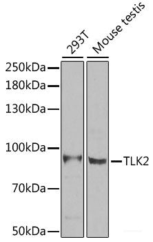 Immunohistochemistry of paraffin-embedded Human prostate using SGCB Polyclonal Antibody at dilution of 1:100 (40x lens).