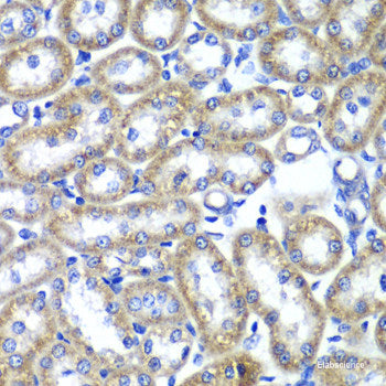 Immunohistochemistry of paraffin-embedded Rat heart using SGCD Polyclonal Antibody at dilution of 1:100 (40x lens).