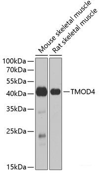 Western blot analysis of extracts of various cell lines using SLC1A5 Polyclonal Antibody at dilution of 1:3000.