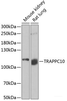 Western blot analysis of extracts of various cell lines using SOD3 Polyclonal Antibody at dilution of 1:1000.