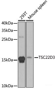 Immunohistochemistry of paraffin-embedded Rat liver using TROVE2 Polyclonal Antibody at dilution of 1:100 (40x lens).