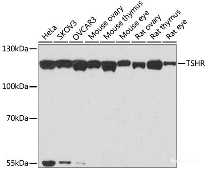 Immunohistochemistry of paraffin-embedded Human colon carcinoma using SSX2 Polyclonal Antibody at dilution of 1:200 (40x lens).