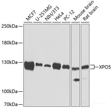 Immunohistochemistry of paraffin-embedded Mouse kidney using TARS Polyclonal Antibody at dilution of 1:100 (40x lens).