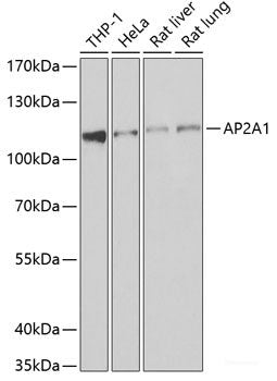Immunofluorescence analysis of U2OS cells using CAMK1 Polyclonal Antibody