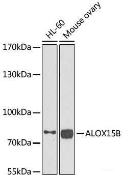 Immunohistochemistry of paraffin-embedded Human gastric damage using ASMTL Polyclonal Antibody at dilution of 1:100 (40x lens).
