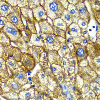 Immunohistochemistry of paraffin-embedded Rat lung using EIF2B2 Polyclonal Antibody at dilution of 1:100 (40x lens).