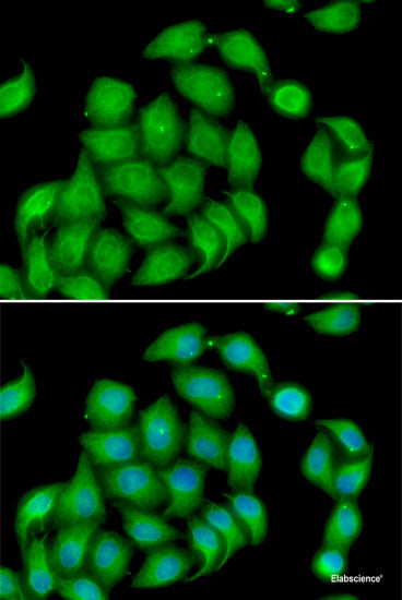 Immunohistochemistry of paraffin-embedded Rat brain using DNAJA3 Polyclonal Antibody at dilution of 1:100 (40x lens).