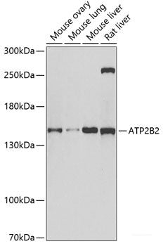 Western blot analysis of extracts of Jurkat cells using CCNE2 Polyclonal Antibody.