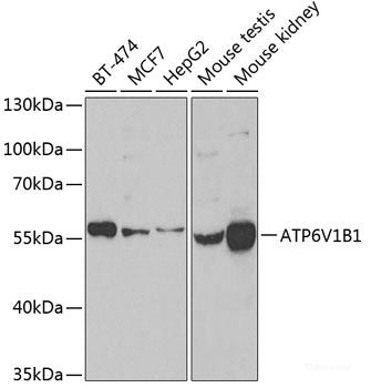 Western blot analysis of extracts of various cell lines using CBFA2T2 Polyclonal Antibody at dilution of 1:1000.