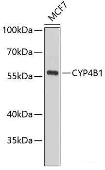 Immunohistochemistry of paraffin-embedded Mouse kidney using NMT2 Polyclonal Antibody at dilution of 1:100 (40x lens).