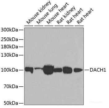 Immunohistochemistry of paraffin-embedded Mouse brain using QKI Polyclonal Antibody at dilution of 1:100 (40x lens).