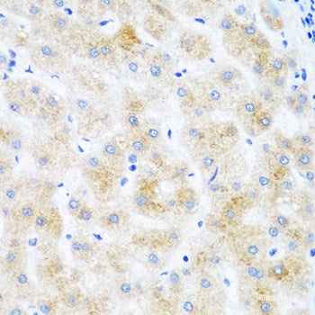 Immunohistochemistry of paraffin-embedded Human kidney using mH2A1 Polyclonal Antibody at dilution of 1:100 (40x lens).