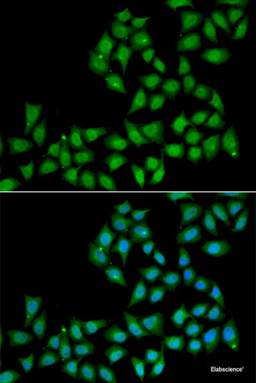 Immunofluorescence analysis of U2OS cells using NCOR1 Polyclonal Antibody