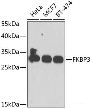 Immunofluorescence analysis of U2OS cells using TOX Polyclonal Antibody