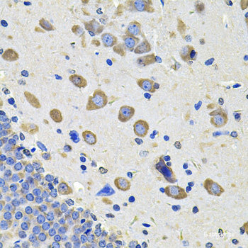 Immunohistochemistry of paraffin-embedded Rat spinal cord using DPP3 Polyclonal Antibody at dilution of 1:100 (40x lens).