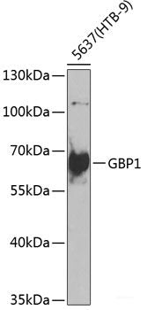 Immunohistochemistry of paraffin-embedded Rat brain using PDIA6 Polyclonal Antibody at dilution of 1:100 (40x lens).