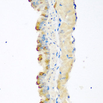 Immunofluorescence analysis of C6 cells using STAM2 Polyclonal Antibody at dilution of 1:100. Blue: DAPI for nuclear staining.