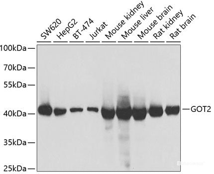 Immunohistochemistry of paraffin-embedded Rat brain using PIAS3 Polyclonal Antibody at dilution of 1:100 (40x lens).