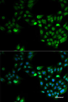 Immunohistochemistry of paraffin-embedded Rat liver using FASTK Polyclonal Antibody at dilution of 1:100 (40x lens).