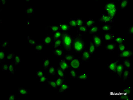 Immunohistochemistry of paraffin-embedded Human stomach using SUB1 Polyclonal Antibody at dilution of 1:100 (40x lens).