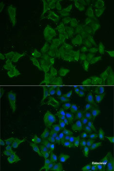 Western blot analysis of extracts of various cell lines using OGFR Polyclonal Antibody at dilution of 1:1000.